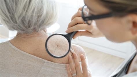 Full Body Skin Exam Skin Exams Pinnacle Dermatology