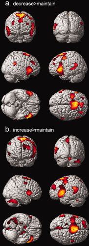 The Neural Correlates Of Sex Differences In Emotional Reactivity And Emotion Regulation Domes