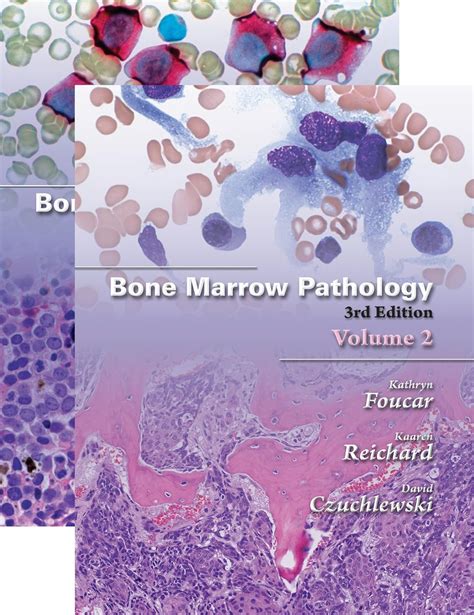 Pathology Outlines Bone Marrow Nonneoplastic