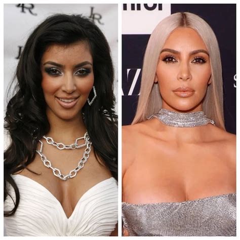 Kim Kardashian S Plastic Surgery Journey Vanity