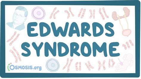 Edwards Syndrome Trisomy 18 Video And Anatomy Osmosis