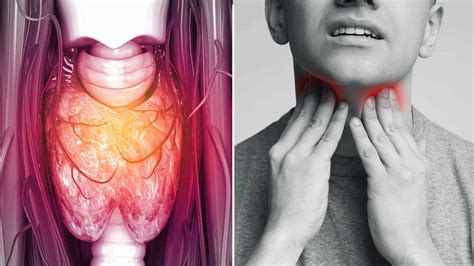 Signs Of Throat Cancer To Never Ignore Minute Read