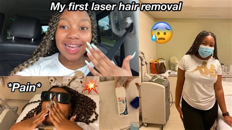 My First Laser Hair Removal Youtube