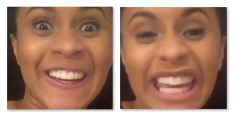 Cardi B Teeth Before And After Old Smile Vs New Empire Bbk
