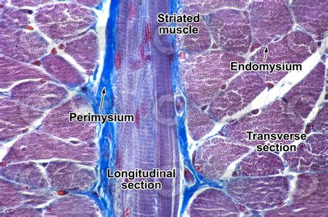 Mammal Skeletal Muscle Transverse Section 500X Skeletal Muscle