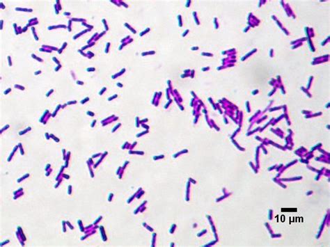 Bacillus Cereus Gram Bacilli Arrangementdiplodouble