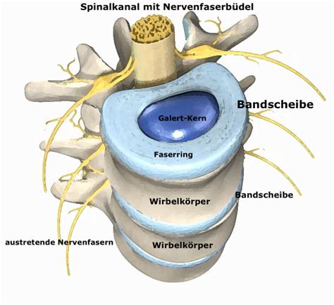 Bandscheibenvorfall Discusprolaps — Osteopathie Wien Craniosakrale