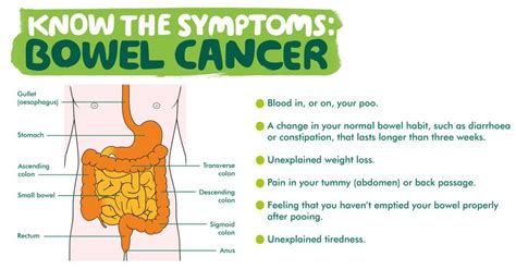 What Are The Symptoms Of Bowel Cancer And Where To Get Help