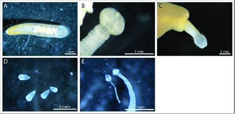 Examples Of Gastrointestinal Parasites Retrieved From Common Eiders In