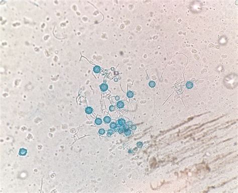June 2019 Case Of The Month Doctor Fungus