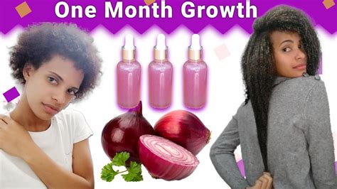 Onion Juice For Hair Growth Before And After Results Youtube