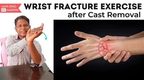 Wrist Fracture Exercise In Hindi Youtube