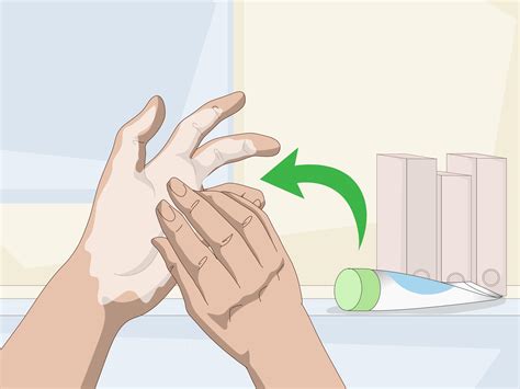 3 Ways To Heal Dry Cracked Hands Wikihow