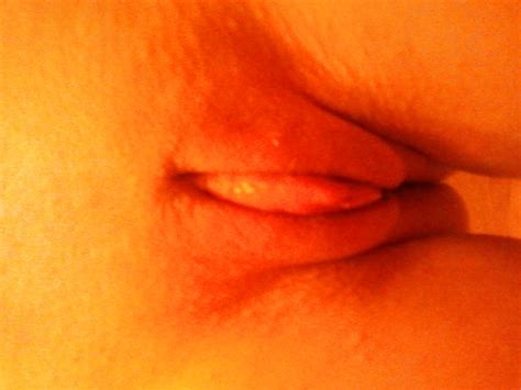 Mi Clitoris Inflamado Porn Pictures Xxx Photos Sex Images 377826