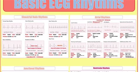 Ecg Educator Blog Basic Ecg Rhythm Strips