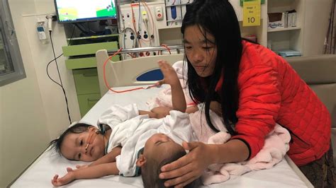 Conjoined Twins Nima Dawa Undergo Separation Surgery In Marathon