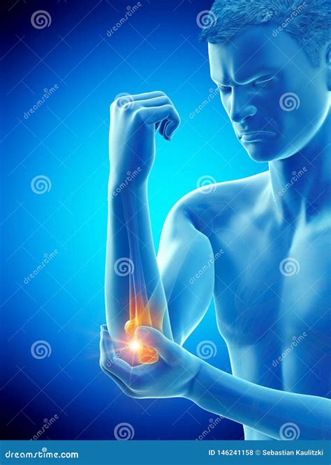 A Man With Painful Elbow Stock Illustration Illustration Of Inflamed