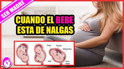 Qué Hacer Cuando El Bebé Está De Nalgas Youtube