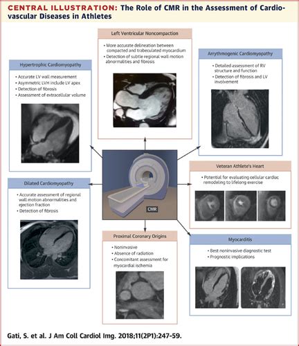 The Role Of Cardiovascular Magnetic Resonance Imaging In The Assessment
