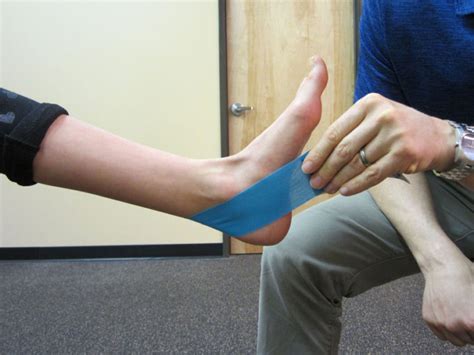 Taping For Posterior Tibialis Tendon Dysfunction Pttd The Physical Therapy Advisor