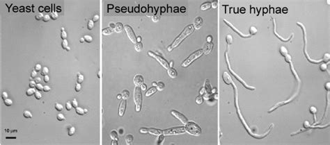 Candida Albicans From Yeast To Hyphae On Curezone Image Gallery