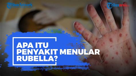 Ciri Ciri Rubella Pada Ibu Hamil Bisabo