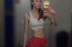 anorexia bodybuilder anorexic muscles 5st scots calories chew weighed gum refused alix survivor goes forfar