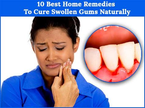 10 Best Home Remedies To Cure Swollen Gums Naturally