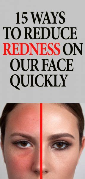 15 Ways To Reduce Redness On Your Face Quickly