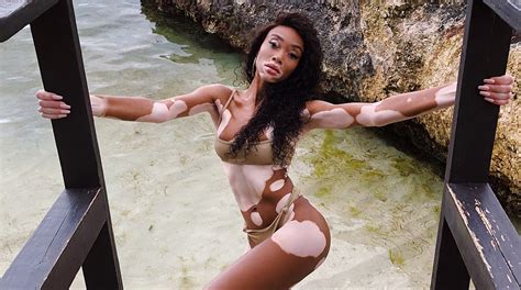 winnie harlow is a 2019 sports illustrated swimsuit model swimsuit