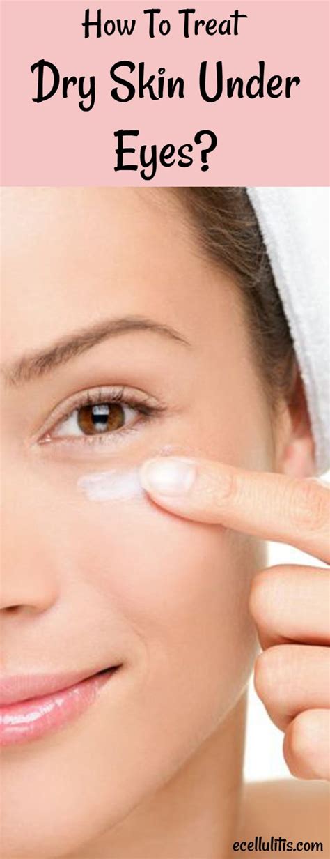 How To Treat Dry Skin Under Eyes Dry Skin Under Eyes Treating Dry