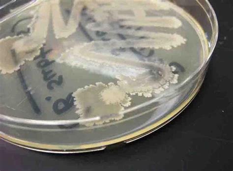 Bacillus Subtilis Bacterial Colonies Grown On Tsy Agar Bacillus