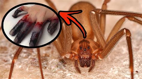 10 Facts About Brown Recluse Spider You Have To Know Youtube