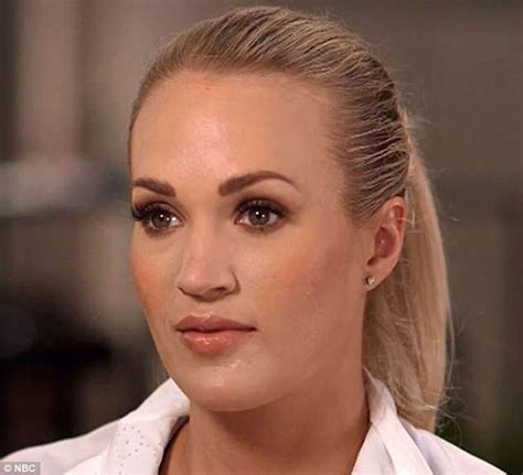 Carrie Underwood Shows Scars In First Tv Interview Since Accident