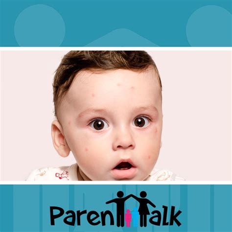 E15 Common Childrens Skin Rashes With Dr Sarah Walkun Parent Talk