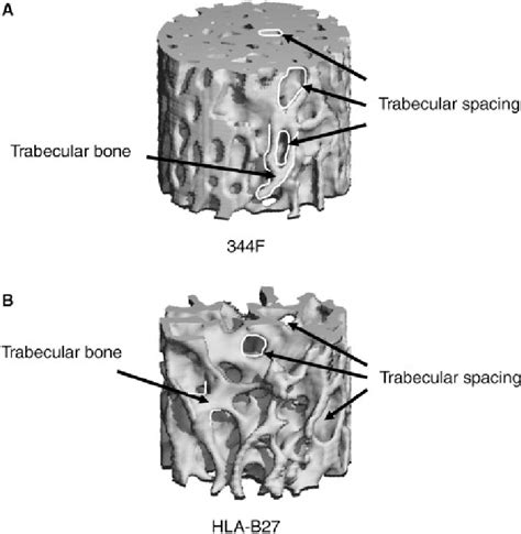 A Segment Of Micro Ct 3 D Scans From The Trabecular Bone In Vertebral