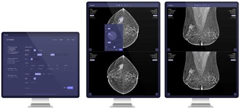 Vara Raises 7 Million For Ai Tool That Spots Early Signs Of Breast