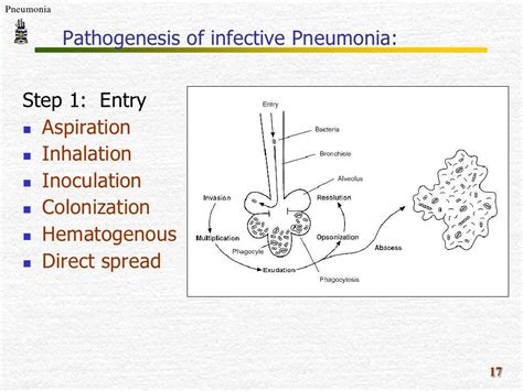 Ppt Pathology Of Pneumonia Powerpoint Presentation Free Download