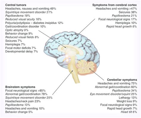 Brain Tumor Pathophysiology Diagram Studying Diagrams