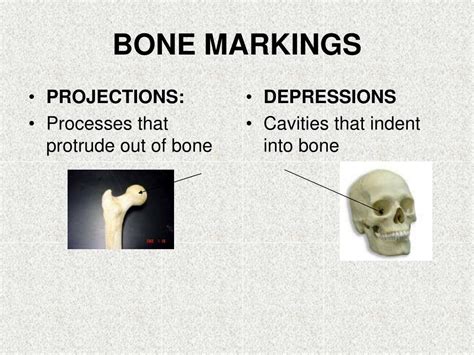 Ppt Bone Markings Powerpoint Presentation Free Download Id2260237