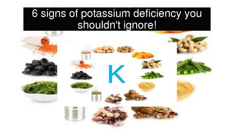 6 Signs Of Potassium Deficiency You Shouldnt Ignore Youtube