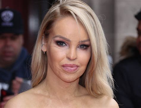 Katie Piper Reveals Acid Attack Brought Her Closer To God
