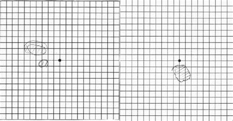 Amsler Grid Eye Chart