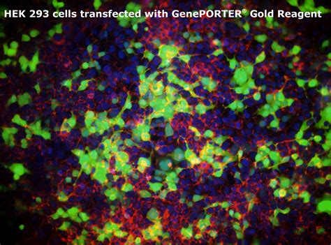 5 the use of human cells for research and development is not an issue for most people. GenePORTER Gold: In Vitro Transfection Reagent - Genlantis