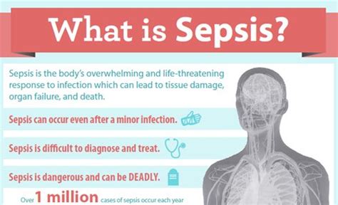 Chemicals released into the blood to fight infection trigger widespread inflammation. LaNell/ @RealScientists on Twitter: "However, Sepsis diagnosis and treatment can be difficult ...