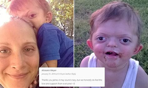 Mother Fights Back Against Trolls Who Used Picture Of Her Disabled Son