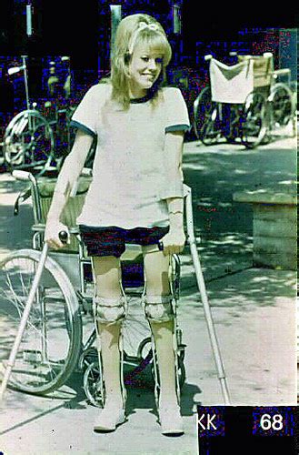 Ribbon 1960s Polio Girl In Kafos A Pretty 1960s Polio Gi Flickr