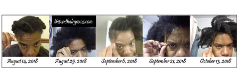 Is black seed oil good for hair loss? 3 Months of Black Seed Oil = Natural Hair Growth