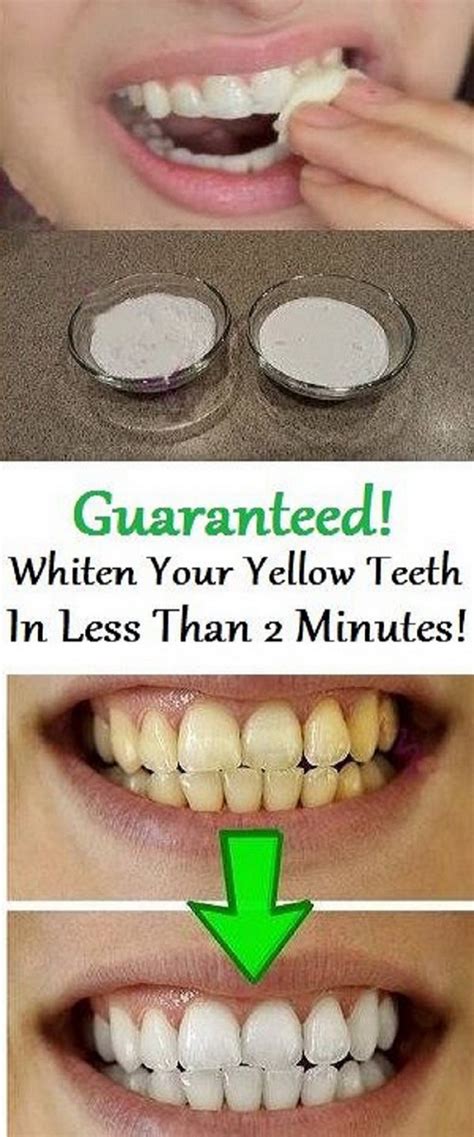 How To Whiten Teeth Naturally At Home