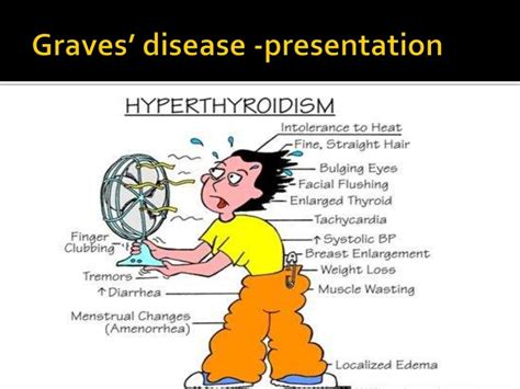 Graves Disease